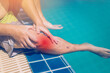 swimmer suffering from knee injured beside swimming pool