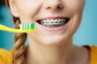Woman with teeth braces using brush