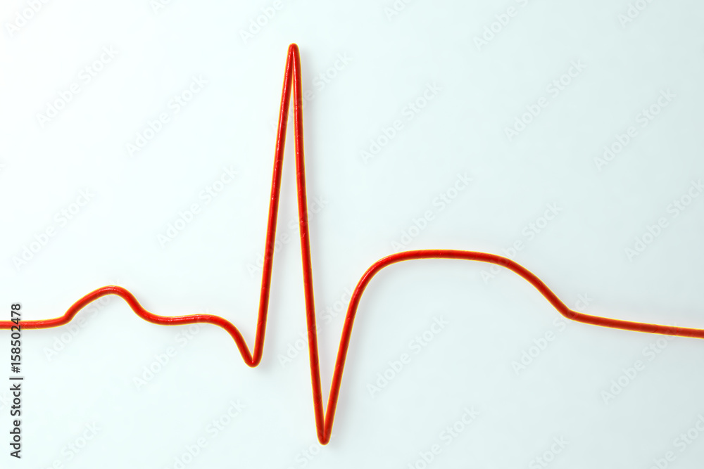 ECG in myocardial infarction. 3D illustration showing ST elevation, non ...