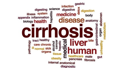 Canvas Print - Cirrhosis animated word cloud, text design animation.