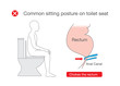 Common posture while sitting on toilet make discomfort at the rectum. Illustration about incorrect position in lifestyle.