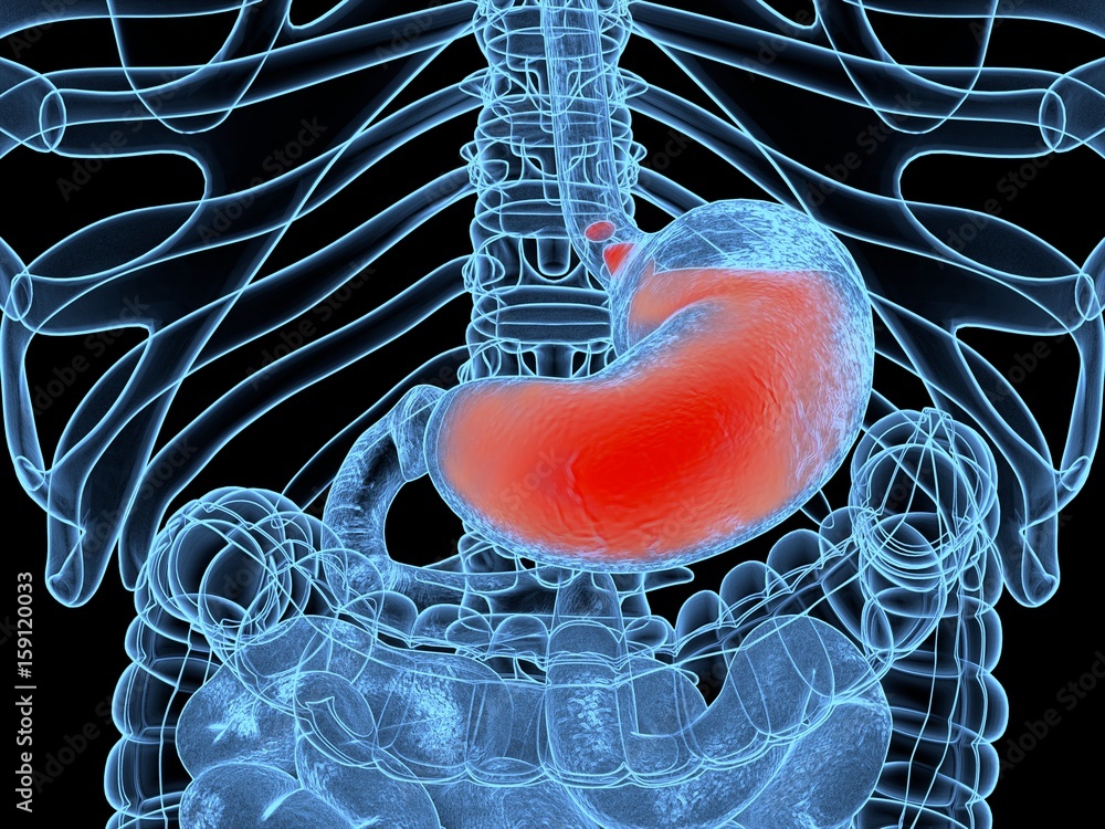 Reflü Acid reflux, GERD. Gastroesophageal reflux disease. Stomach and ...