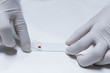 sample for blood smear method