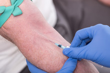 Injection Of A Catheter In The Arm