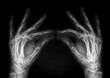 hands radiography