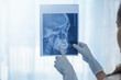 © tonefotografia - Female dentist holding a dental X-Ray