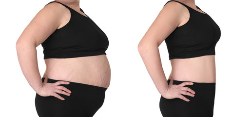 Poster - Female body before and after weightloss on white background. Health care and diet concept