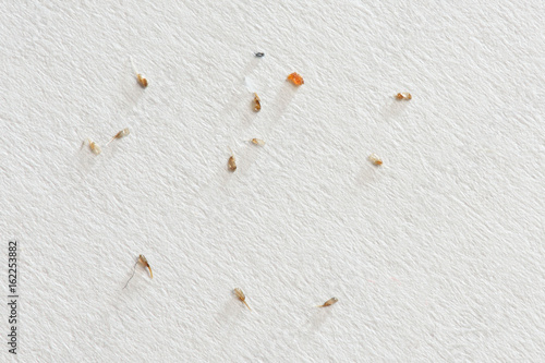 Nits Removed From The Hair On White Paper Background Buy This