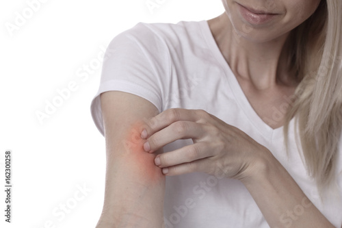 Fotografía Woman Scratching an itch on white background