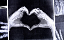 X-ray Image Of Hands Making Heart Symbols.