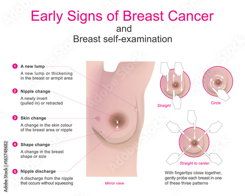 Self Breast Exam Chart