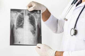 Wall Mural - Doctor examining a lung radiography, Doctor looking chest x-ray film,Anatomy.