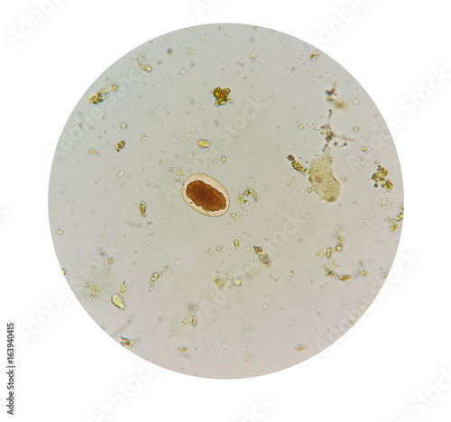 Stool parasites examination test for parasites or eggs in human stool