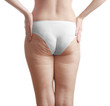 © Africa Studio - Woman with cellulite on buttocks and legs against white background