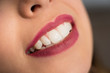 Close up of beautiful young smiling woman with perfect teeth in dental office. Dentistry