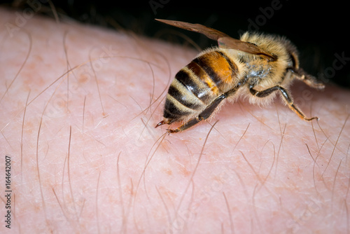 Zdjęcie XXL Pszczoła miodna (Apis mellifera) użądlenia w skórze człowieka