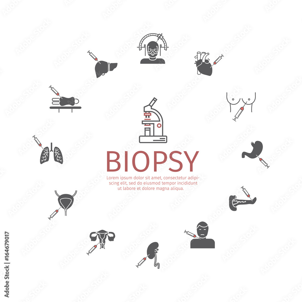 Biopsy: Types of biopsy procedures used to diagnose cancer - obrazy, fototapety, plakaty 