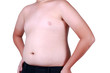 © thechatat - The size of stomach of children with overweight.