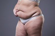 © staras - Woman with fat abdomen, overweight female stomach