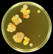Colorful bacterial colonies like flowers. Human fingerprints on meat-peptone agar in petri dish. Manual isolation.