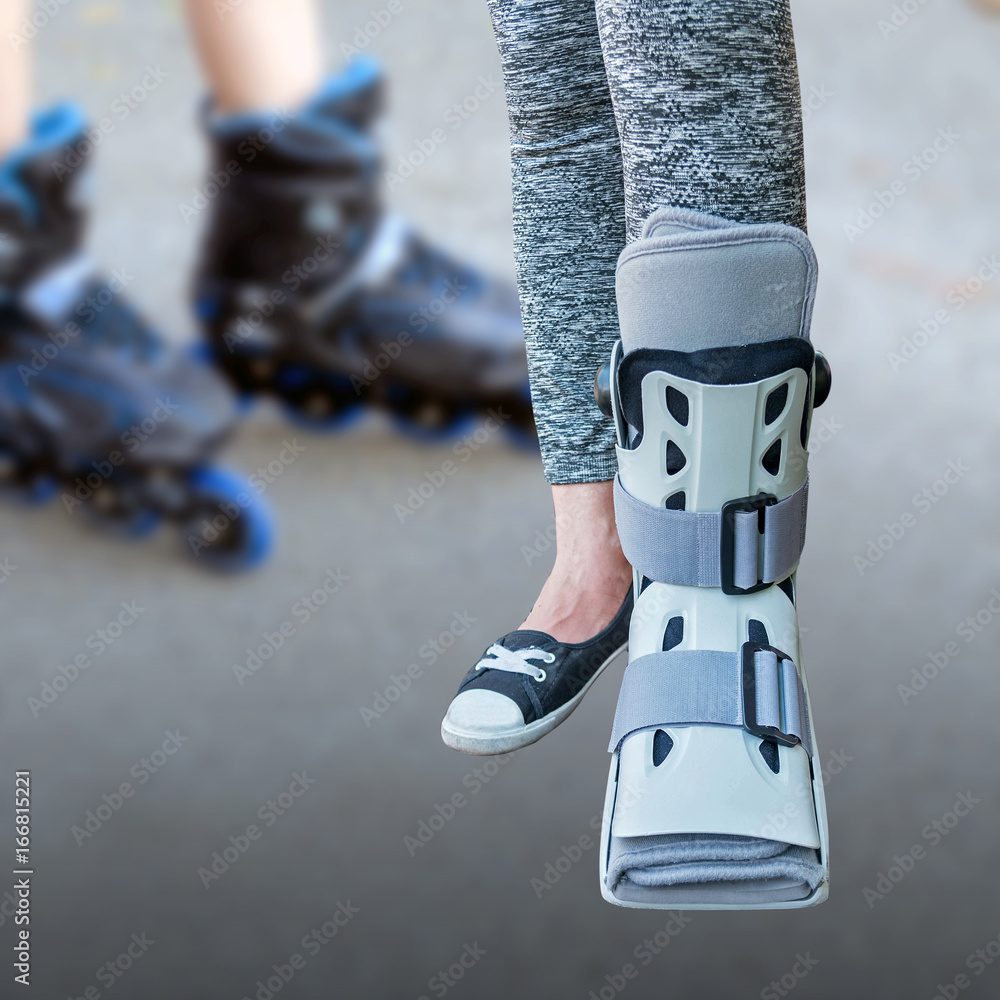 broken leg, short leg cast, splint for treatment of injured woman wearing  sportswear and ankle support on black roller skates background Stock Photo  | Adobe Stock, image size:1000x1000
