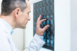 © Viacheslav Yakobchuk - Close up of doctor analyzing results of computer tomography