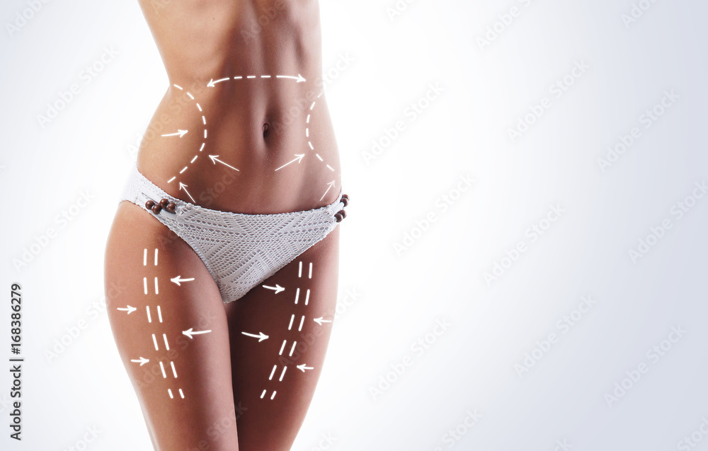Female body with the drawing arrows on it. Fat lose, liposuction and cellulite removal concept. - obrazy, fototapety, plakaty 