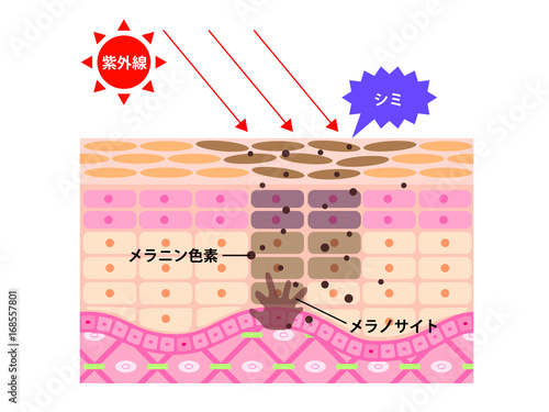 肌　断面図　日焼け　シミ