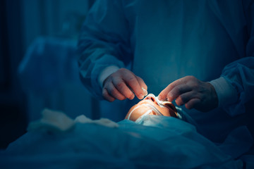 Surgeon wearing gloves operates women's nose . Operation close up.