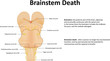 Brainstem Death