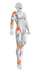 Poster - Conceptual human muscle anatomy with red and yellow hot spot inflammation or articular joint pain for health care therapy or sport concepts. 3D illustration man arthritis or bone osteoporosis disease