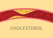a cholesterol human body vein with blood cell stream