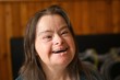 portrait of young adult woman with down syndrome