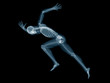 © Sebastian Kaulitzki - 3d rendered medically accurate illustration of a sprinter x-ray