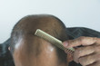 Head of man lose one's hair, glabrous on his head for elderly man