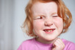 © Olga Sidel'nikova - Beautiful red-haired girl with dental caries