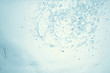 © kichigin19 - underwater air bubbles texture light blue background