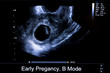 © Belish - Colourful image of pregnancy ultrasound monitor