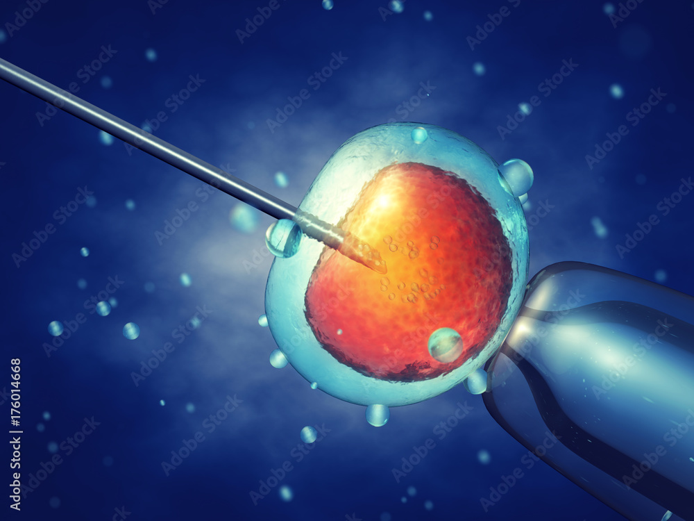 In vitro fertilisation , Injecting sperm into egg cell , Assisted reproductive treatment - obrazy, fototapety, plakaty 