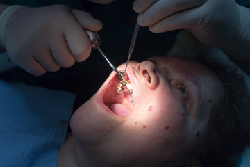 Wall Mural - The dentist works with the client in the clinic