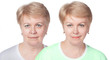 Elderly woman. Comparison before and after rejuvenation. Selective focus