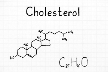 Chemical formula of Cholesterol.