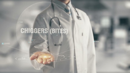 Poster - Doctor holding in hand Chiggers Bites 