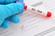 © jarun011 - Blood sample with requisition form for sexually transmitted infection (STI) test