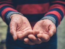 Close Up On A Man With Spots On Hands Begging