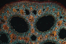 Plant Cells Micrograph