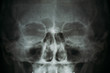 © DedMityay - X-ray image or roentgen of human skull, close-up. Head xray scan of skeleton eyes and nose. Abstract medical clinic anatomy concept