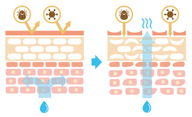 Wall Mural - Sectional view of the skin.Comparison illustration of protection effect between healthy skin and wounded skin. No text.