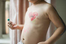 Kid Has Drawing Of Heart On His Body