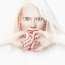 Albino Girl With White Skin, Natural Lips And White Hair. Photo Face On A Light Background. Portrait Of The Head. Blonde Girl